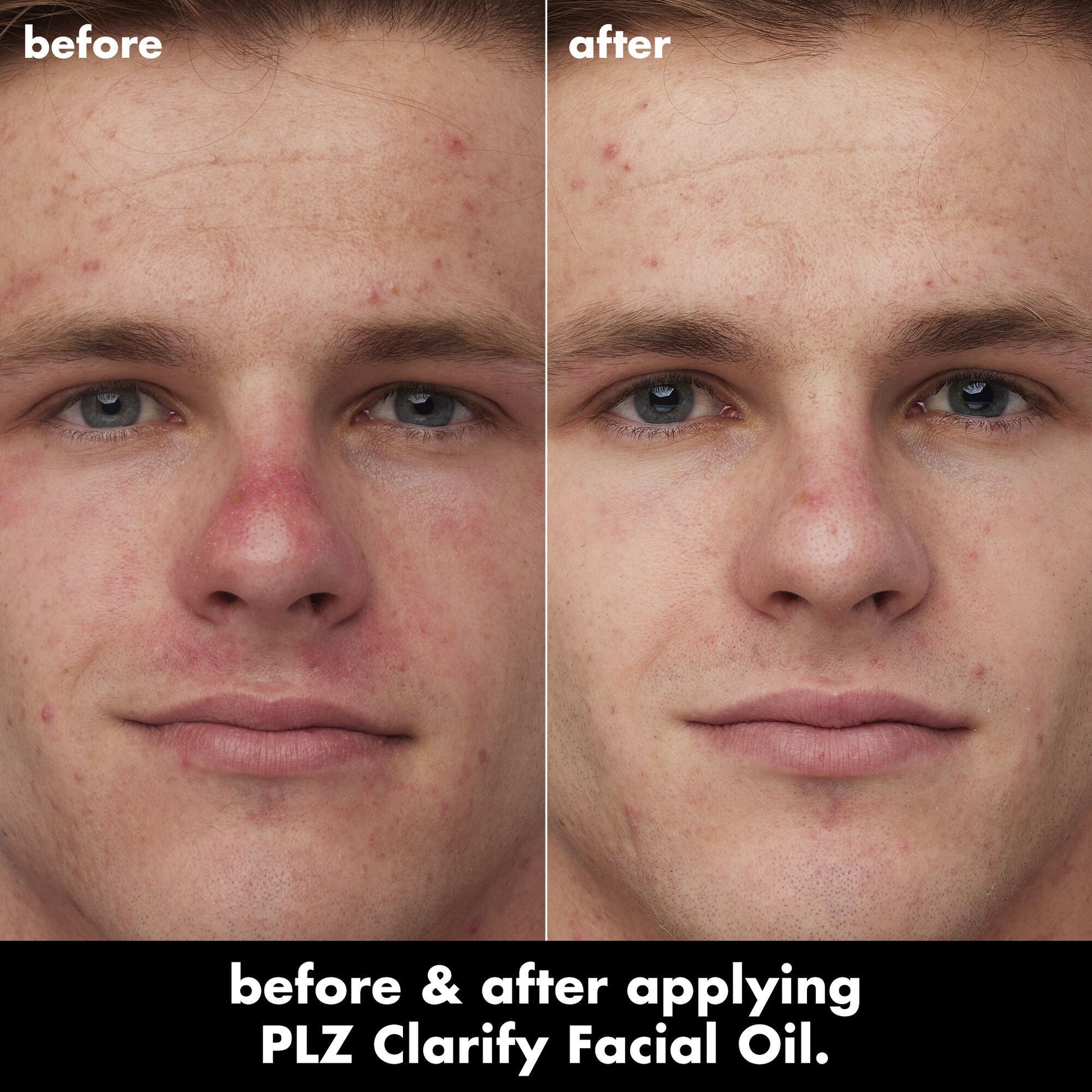 plz-clarify-facial-oil-a1 0326_EDU_PlzClarify_BA_Caleb.jpg