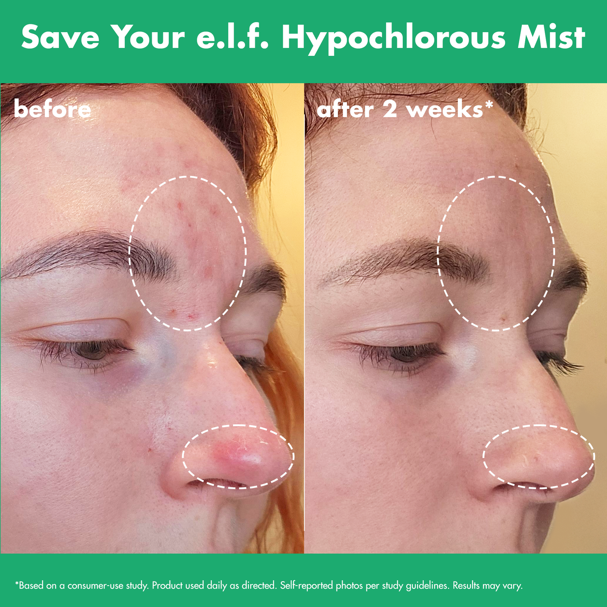 save-your-e-l-f-hypochlorous-mist-r9 FA26_EDUCATION_SAVEYOURELF_USAGE_BA1_WITHOUT_CLAIMS.png